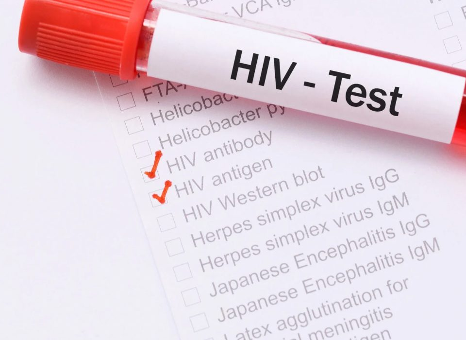 Kocaeli'de Anonim ve Ücretsiz HIV Testi Hizmeti Başladı