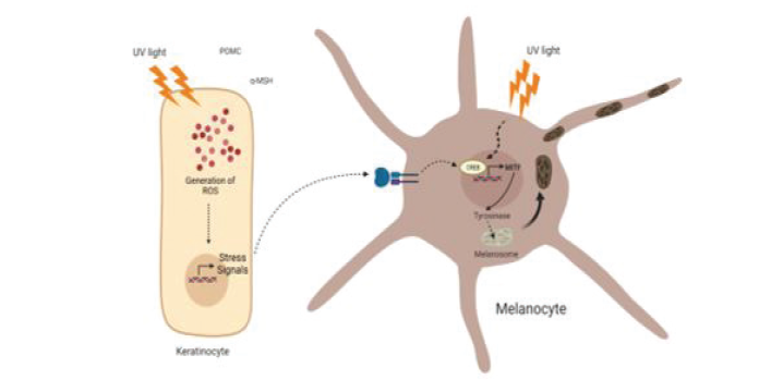 Skin Hyperpigmentation: Understanding the Influence of the Exposome