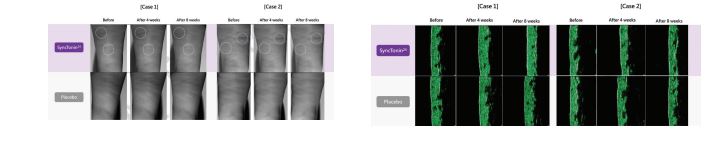 SyncTonin 24 figure