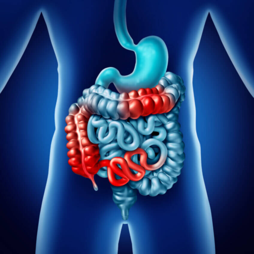 Sindirim Sistemini Ele Geçiren Crohn Hastalığı Nedir?